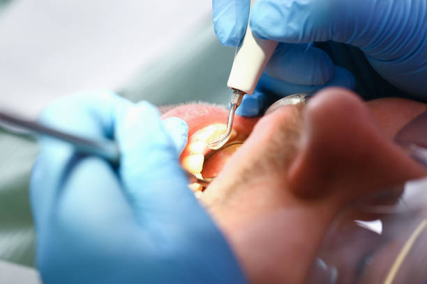 Best Urgent Care for Lost Fillings or Crowns in Perryopolis, PA