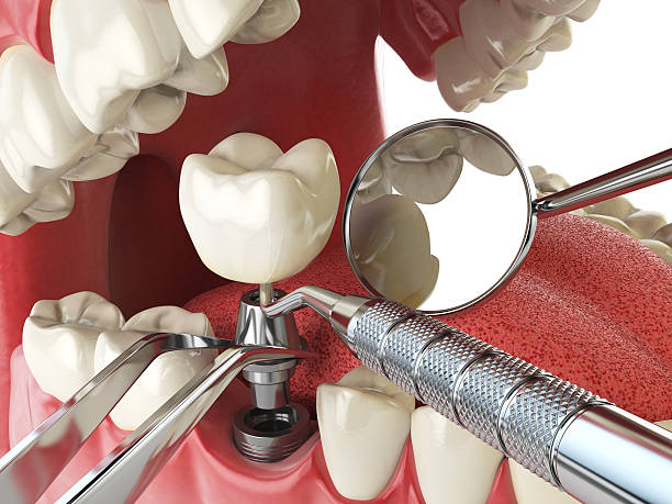 Best Emergency Tooth Extraction in Perryopolis, PA